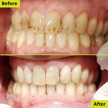 Patient result 1