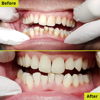 Patient result 2