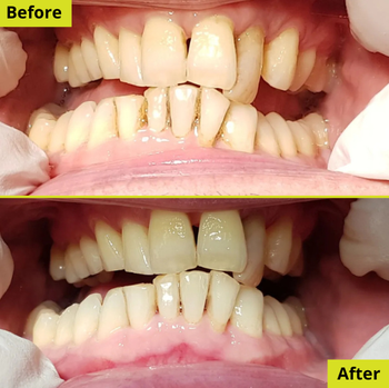 Patient result 3